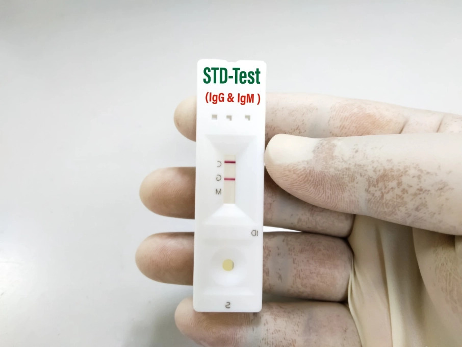 Best At-Home STD Tests of 2024